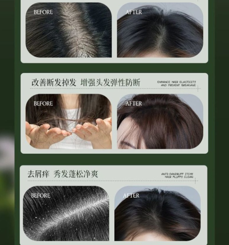 Champú de Hierba Usman AJAK pa - Hair Care Dandruff reseña y precio